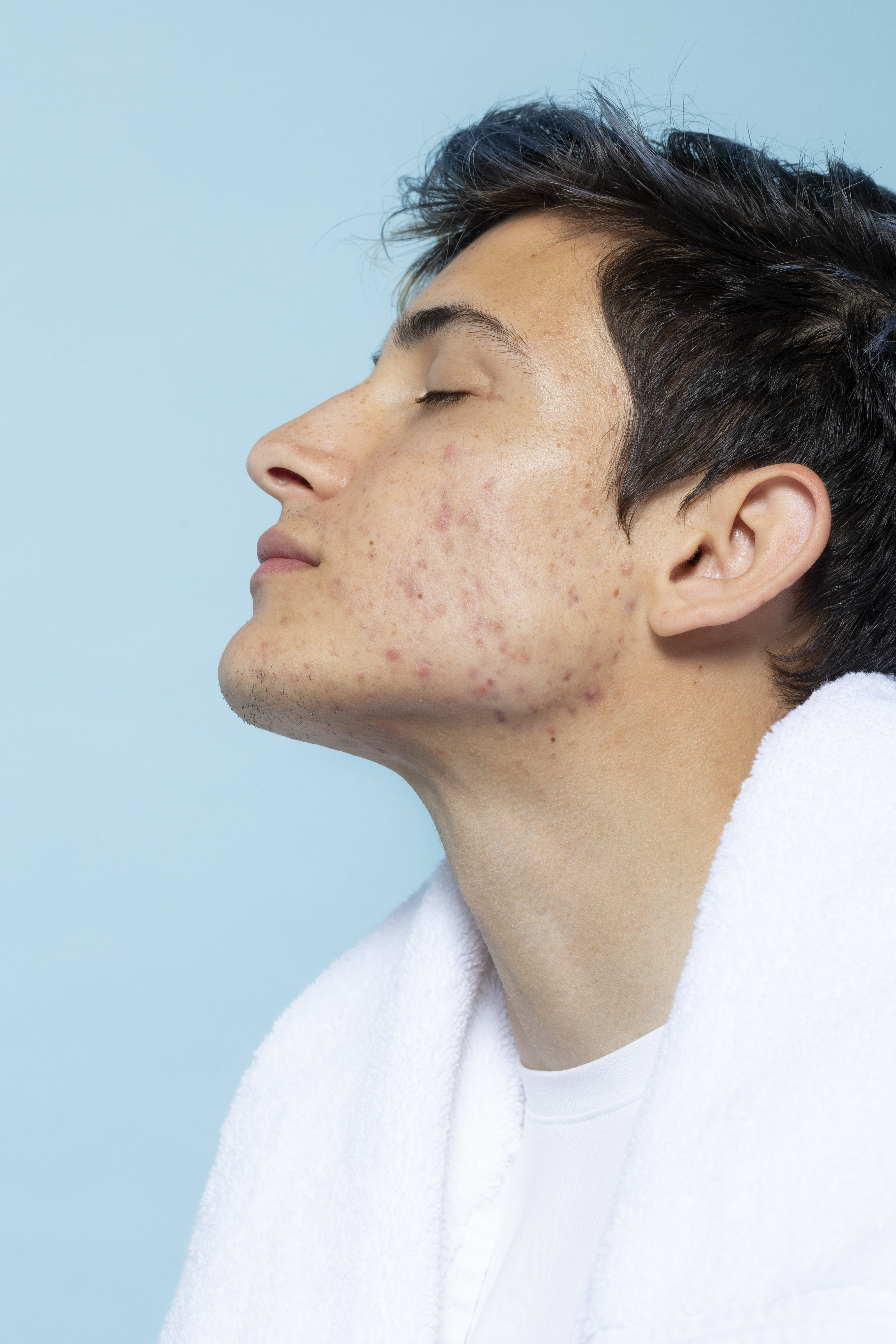 Hair Transplant in Madurai, hair clinic in Madurai, Skin Care in Madurai, Laser Treatment in Madurai, Hair Care in Madurai, hydra facial in Madurai, Hair Transplant near me, hair clinic near me, Skin Care near me, Hair Transplant in Madurai, best hair clinic in Madurai, best hydra facial in Madurai,  best hair transplantation clinic in madurai, best laser unwanted hair removal in Madurai, Best Hair Restoration in Madurai, Best Hair Replacement in Madurai, Best Hair Transplant Surgery in Madurai, Best Hair Loss Treatment in Madurai, Best Hair Grafting in Madurai, Best Hair Regrowth in Madurai, Best Hair Loss Solutions in Madurai, Best Hair Transplant Clinics in Madurai, Best Baldness Treatment in Madurai, Best Hair Transplant Recovery in Madurai, Best Hair Transplant Cost in Madurai, Best Hairline Restoration in Madurai, Best Scalp Treatments in Madurai, Best Hair Thinning Solutions in Madurai, Best skin clinic in madurai, Best laser treatment in madurai, best acne scar treatment in madurai, Best chemical peels in madurai , Best laser tattoo removal clinic in madurai , Best hair fall treatment clinic in madurai , best laser skin rejuvenation clinic in madurai , Best laser scar reduction clinic in madurai, best skin brightening treatment in Madurai, Best Hair Regrowth in Madurai, Best Hair Loss Solutions in Madurai, Best Hair Transplant Clinics in Madurai, Best Baldness Treatment in Madurai, Best Hair Transplant Recovery in Madurai, Best Hair Transplant Cost in Madurai, Best Hairline Restoration in Madurai, Best Scalp Treatments in Madurai, Best Hair Thinning Solutions in Madurai, Best Hair Transplant Before and After in Madurai, Best Hair Transplant Consultation in Madurai, Laser Hair Removal in Madurai, Laser Skin Therapy in Madurai, Laser Skin Resurfacing in Madurai, Best Follicular Unit Transplantation (FUT) in Madurai, Best Follicular Unit Extraction (FUE) in Madurai, Best Scalp Micropigmentation in Madurai, Best  Dark Circle Solutions in Madurai, Black Eye Treatment  in Madurai, Best Beauty Therapist in Madurai, Color-Centric Skincare in Madurai, Hue-Based Skin Treatment in Madurai, Skincare for All Hues in Madurai, Skin Care for Diverse Hues in Madurai, Skin Tone-Specific Treatments in Madurai, Skincare Solutions for Every Hue in Madurai, Hue-Specific Dermatology in Madurai, Skincare by Skin Tone in Madurai, Tailored Skin Treatment for Hues in Madurai, Personalized Skincare by Hues in Madurai, Skin Care for Various Hues in Madurai, Color-Based Skin Care in Madurai, Skin Health for All Tones in Madurai, Laser Skin Tightening in Madurai, Laser Wrinkle Reduction in Madurai, Laser Scar Removal in Madurai, Laser Pigmentation Treatment in Madurai, Laser Acne Treatment in Madurai, Laser Skin Rejuvenation in Madurai, Laser Tattoo Removal in Madurai, Non-Invasive Laser Treatment in Madurai, Laser Skin Care in Madurai, Medical Laser Treatment in Madurai, Laser Dermatology in Madurai, Advanced Laser Therapy in Madurai, Cosmetic Laser Procedures in Madurai, Laser Anti-Aging in Madurai, Fractional Laser Treatment in Madurai, Laser Treatment Recovery in Madurai, Hair Treatment in Madurai, Hair Restoration in Madurai, Hair Health in Madurai, Hair Growth in Madurai, Hair Repair in Madurai, Hair Loss Prevention in Madurai, Hair Conditioning in Madurai, Hair Strengthening in Madurai, Scalp Treatment in Madurai, Hair Moisturization in Madurai, Split Ends Repair in Madurai, Natural Hair Treatments in Madurai, Hair Coloring in Madurai, Heat Damage Repair in Madurai, Hair Masks in Madurai, Organic Hair Care in Madurai, Hair Shine in Madurai, Frizz Control in Madurai, Hair Serums in Madurai.