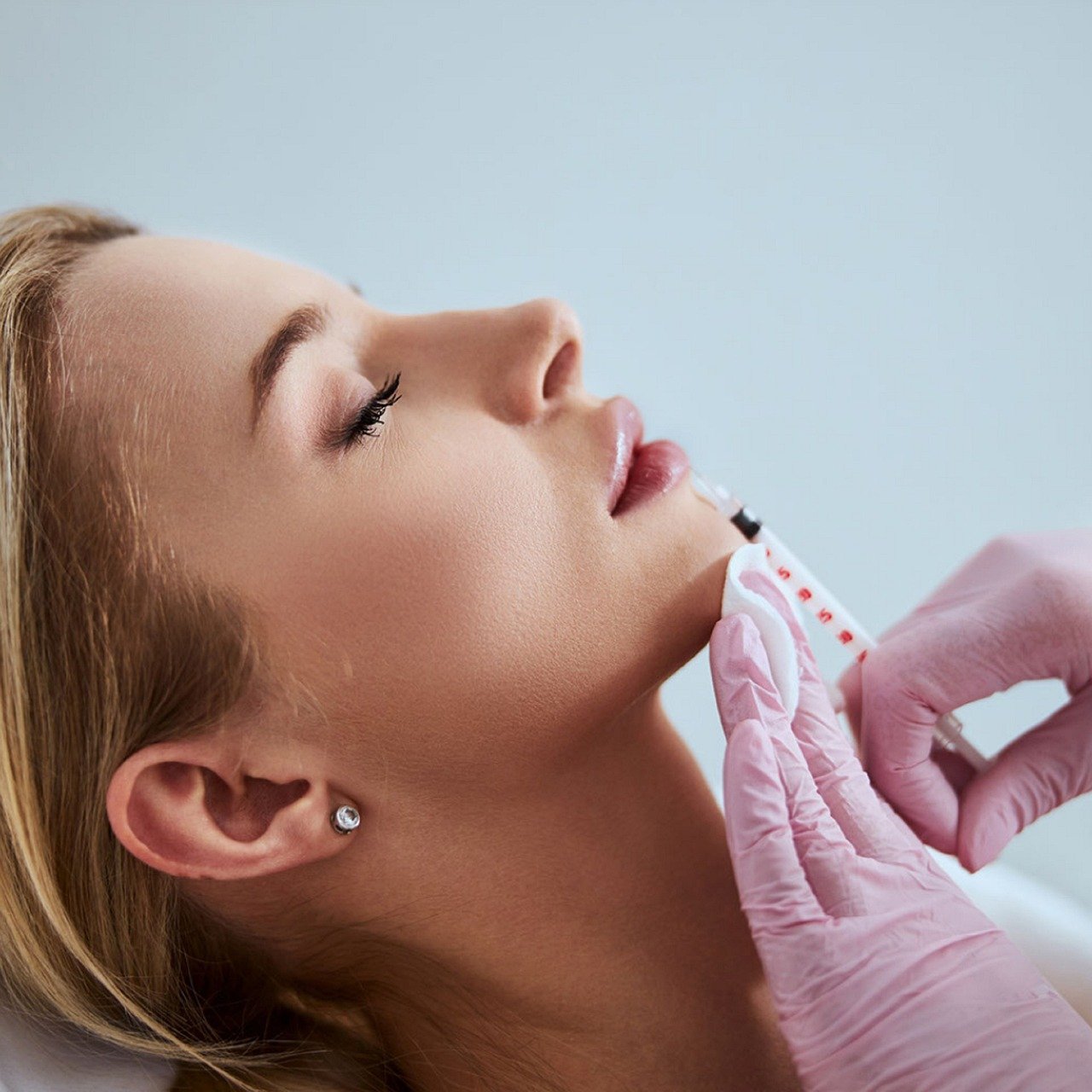 Hair Transplant in Madurai, hair clinic in Madurai, Skin Care in Madurai, Laser Treatment in Madurai, Hair Care in Madurai, hydra facial in Madurai, Hair Transplant near me, hair clinic near me, Skin Care near me, Hair Transplant in Madurai, best hair clinic in Madurai, best hydra facial in Madurai,  best hair transplantation clinic in madurai, best laser unwanted hair removal in Madurai, Best Hair Restoration in Madurai, Best Hair Replacement in Madurai, Best Hair Transplant Surgery in Madurai, Best Hair Loss Treatment in Madurai, Best Hair Grafting in Madurai, Best Hair Regrowth in Madurai, Best Hair Loss Solutions in Madurai, Best Hair Transplant Clinics in Madurai, Best Baldness Treatment in Madurai, Best Hair Transplant Recovery in Madurai, Best Hair Transplant Cost in Madurai, Best Hairline Restoration in Madurai, Best Scalp Treatments in Madurai, Best Hair Thinning Solutions in Madurai, Best skin clinic in madurai, Best laser treatment in madurai, best acne scar treatment in madurai, Best chemical peels in madurai , Best laser tattoo removal clinic in madurai , Best hair fall treatment clinic in madurai , best laser skin rejuvenation clinic in madurai , Best laser scar reduction clinic in madurai, best skin brightening treatment in Madurai, Best Hair Regrowth in Madurai, Best Hair Loss Solutions in Madurai, Best Hair Transplant Clinics in Madurai, Best Baldness Treatment in Madurai, Best Hair Transplant Recovery in Madurai, Best Hair Transplant Cost in Madurai, Best Hairline Restoration in Madurai, Best Scalp Treatments in Madurai, Best Hair Thinning Solutions in Madurai, Best Hair Transplant Before and After in Madurai, Best Hair Transplant Consultation in Madurai, Laser Hair Removal in Madurai, Laser Skin Therapy in Madurai, Laser Skin Resurfacing in Madurai, Best Follicular Unit Transplantation (FUT) in Madurai, Best Follicular Unit Extraction (FUE) in Madurai, Best Scalp Micropigmentation in Madurai, Best  Dark Circle Solutions in Madurai, Black Eye Treatment  in Madurai, Best Beauty Therapist in Madurai, Color-Centric Skincare in Madurai, Hue-Based Skin Treatment in Madurai, Skincare for All Hues in Madurai, Skin Care for Diverse Hues in Madurai, Skin Tone-Specific Treatments in Madurai, Skincare Solutions for Every Hue in Madurai, Hue-Specific Dermatology in Madurai, Skincare by Skin Tone in Madurai, Tailored Skin Treatment for Hues in Madurai, Personalized Skincare by Hues in Madurai, Skin Care for Various Hues in Madurai, Color-Based Skin Care in Madurai, Skin Health for All Tones in Madurai, Laser Skin Tightening in Madurai, Laser Wrinkle Reduction in Madurai, Laser Scar Removal in Madurai, Laser Pigmentation Treatment in Madurai, Laser Acne Treatment in Madurai, Laser Skin Rejuvenation in Madurai, Laser Tattoo Removal in Madurai, Non-Invasive Laser Treatment in Madurai, Laser Skin Care in Madurai, Medical Laser Treatment in Madurai, Laser Dermatology in Madurai, Advanced Laser Therapy in Madurai, Cosmetic Laser Procedures in Madurai, Laser Anti-Aging in Madurai, Fractional Laser Treatment in Madurai, Laser Treatment Recovery in Madurai, Hair Treatment in Madurai, Hair Restoration in Madurai, Hair Health in Madurai, Hair Growth in Madurai, Hair Repair in Madurai, Hair Loss Prevention in Madurai, Hair Conditioning in Madurai, Hair Strengthening in Madurai, Scalp Treatment in Madurai, Hair Moisturization in Madurai, Split Ends Repair in Madurai, Natural Hair Treatments in Madurai, Hair Coloring in Madurai, Heat Damage Repair in Madurai, Hair Masks in Madurai, Organic Hair Care in Madurai, Hair Shine in Madurai, Frizz Control in Madurai, Hair Serums in Madurai.