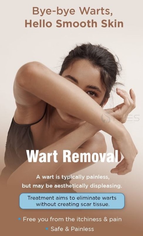 Hair Transplant in Madurai, hair clinic in Madurai, Skin Care in Madurai, Laser Treatment in Madurai, Hair Care in Madurai, hydra facial in Madurai, Hair Transplant near me, hair clinic near me, Skin Care near me, Hair Transplant in Madurai, best hair clinic in Madurai, best hydra facial in Madurai,  best hair transplantation clinic in madurai, best laser unwanted hair removal in Madurai, Best Hair Restoration in Madurai, Best Hair Replacement in Madurai, Best Hair Transplant Surgery in Madurai, Best Hair Loss Treatment in Madurai, Best Hair Grafting in Madurai, Best Hair Regrowth in Madurai, Best Hair Loss Solutions in Madurai, Best Hair Transplant Clinics in Madurai, Best Baldness Treatment in Madurai, Best Hair Transplant Recovery in Madurai, Best Hair Transplant Cost in Madurai, Best Hairline Restoration in Madurai, Best Scalp Treatments in Madurai, Best Hair Thinning Solutions in Madurai, Best skin clinic in madurai, Best laser treatment in madurai, best acne scar treatment in madurai, Best chemical peels in madurai , Best laser tattoo removal clinic in madurai , Best hair fall treatment clinic in madurai , best laser skin rejuvenation clinic in madurai , Best laser scar reduction clinic in madurai, best skin brightening treatment in Madurai, Best Hair Regrowth in Madurai, Best Hair Loss Solutions in Madurai, Best Hair Transplant Clinics in Madurai, Best Baldness Treatment in Madurai, Best Hair Transplant Recovery in Madurai, Best Hair Transplant Cost in Madurai, Best Hairline Restoration in Madurai, Best Scalp Treatments in Madurai, Best Hair Thinning Solutions in Madurai, Best Hair Transplant Before and After in Madurai, Best Hair Transplant Consultation in Madurai, Laser Hair Removal in Madurai, Laser Skin Therapy in Madurai, Laser Skin Resurfacing in Madurai, Best Follicular Unit Transplantation (FUT) in Madurai, Best Follicular Unit Extraction (FUE) in Madurai, Best Scalp Micropigmentation in Madurai, Best  Dark Circle Solutions in Madurai, Black Eye Treatment  in Madurai, Best Beauty Therapist in Madurai, Color-Centric Skincare in Madurai, Hue-Based Skin Treatment in Madurai, Skincare for All Hues in Madurai, Skin Care for Diverse Hues in Madurai, Skin Tone-Specific Treatments in Madurai, Skincare Solutions for Every Hue in Madurai, Hue-Specific Dermatology in Madurai, Skincare by Skin Tone in Madurai, Tailored Skin Treatment for Hues in Madurai, Personalized Skincare by Hues in Madurai, Skin Care for Various Hues in Madurai, Color-Based Skin Care in Madurai, Skin Health for All Tones in Madurai, Laser Skin Tightening in Madurai, Laser Wrinkle Reduction in Madurai, Laser Scar Removal in Madurai, Laser Pigmentation Treatment in Madurai, Laser Acne Treatment in Madurai, Laser Skin Rejuvenation in Madurai, Laser Tattoo Removal in Madurai, Non-Invasive Laser Treatment in Madurai, Laser Skin Care in Madurai, Medical Laser Treatment in Madurai, Laser Dermatology in Madurai, Advanced Laser Therapy in Madurai, Cosmetic Laser Procedures in Madurai, Laser Anti-Aging in Madurai, Fractional Laser Treatment in Madurai, Laser Treatment Recovery in Madurai, Hair Treatment in Madurai, Hair Restoration in Madurai, Hair Health in Madurai, Hair Growth in Madurai, Hair Repair in Madurai, Hair Loss Prevention in Madurai, Hair Conditioning in Madurai, Hair Strengthening in Madurai, Scalp Treatment in Madurai, Hair Moisturization in Madurai, Split Ends Repair in Madurai, Natural Hair Treatments in Madurai, Hair Coloring in Madurai, Heat Damage Repair in Madurai, Hair Masks in Madurai, Organic Hair Care in Madurai, Hair Shine in Madurai, Frizz Control in Madurai, Hair Serums in Madurai.
