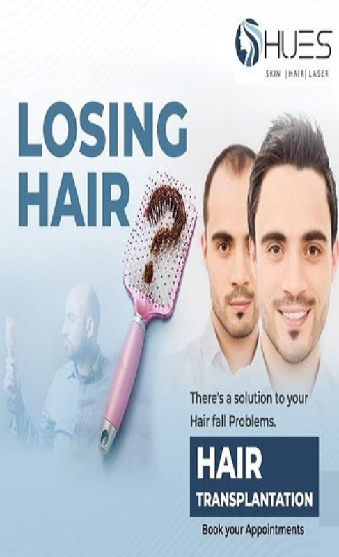 Hair Transplant in Madurai, hair clinic in Madurai, Skin Care in Madurai, Laser Treatment in Madurai, Hair Care in Madurai, hydra facial in Madurai, Hair Transplant near me, hair clinic near me, Skin Care near me, Hair Transplant in Madurai, best hair clinic in Madurai, best hydra facial in Madurai,  best hair transplantation clinic in madurai, best laser unwanted hair removal in Madurai, Best Hair Restoration in Madurai, Best Hair Replacement in Madurai, Best Hair Transplant Surgery in Madurai, Best Hair Loss Treatment in Madurai, Best Hair Grafting in Madurai, Best Hair Regrowth in Madurai, Best Hair Loss Solutions in Madurai, Best Hair Transplant Clinics in Madurai, Best Baldness Treatment in Madurai, Best Hair Transplant Recovery in Madurai, Best Hair Transplant Cost in Madurai, Best Hairline Restoration in Madurai, Best Scalp Treatments in Madurai, Best Hair Thinning Solutions in Madurai, Best skin clinic in madurai, Best laser treatment in madurai, best acne scar treatment in madurai, Best chemical peels in madurai , Best laser tattoo removal clinic in madurai , Best hair fall treatment clinic in madurai , best laser skin rejuvenation clinic in madurai , Best laser scar reduction clinic in madurai, best skin brightening treatment in Madurai, Best Hair Regrowth in Madurai, Best Hair Loss Solutions in Madurai, Best Hair Transplant Clinics in Madurai, Best Baldness Treatment in Madurai, Best Hair Transplant Recovery in Madurai, Best Hair Transplant Cost in Madurai, Best Hairline Restoration in Madurai, Best Scalp Treatments in Madurai, Best Hair Thinning Solutions in Madurai, Best Hair Transplant Before and After in Madurai, Best Hair Transplant Consultation in Madurai, Laser Hair Removal in Madurai, Laser Skin Therapy in Madurai, Laser Skin Resurfacing in Madurai, Best Follicular Unit Transplantation (FUT) in Madurai, Best Follicular Unit Extraction (FUE) in Madurai, Best Scalp Micropigmentation in Madurai, Best  Dark Circle Solutions in Madurai, Black Eye Treatment  in Madurai, Best Beauty Therapist in Madurai, Color-Centric Skincare in Madurai, Hue-Based Skin Treatment in Madurai, Skincare for All Hues in Madurai, Skin Care for Diverse Hues in Madurai, Skin Tone-Specific Treatments in Madurai, Skincare Solutions for Every Hue in Madurai, Hue-Specific Dermatology in Madurai, Skincare by Skin Tone in Madurai, Tailored Skin Treatment for Hues in Madurai, Personalized Skincare by Hues in Madurai, Skin Care for Various Hues in Madurai, Color-Based Skin Care in Madurai, Skin Health for All Tones in Madurai, Laser Skin Tightening in Madurai, Laser Wrinkle Reduction in Madurai, Laser Scar Removal in Madurai, Laser Pigmentation Treatment in Madurai, Laser Acne Treatment in Madurai, Laser Skin Rejuvenation in Madurai, Laser Tattoo Removal in Madurai, Non-Invasive Laser Treatment in Madurai, Laser Skin Care in Madurai, Medical Laser Treatment in Madurai, Laser Dermatology in Madurai, Advanced Laser Therapy in Madurai, Cosmetic Laser Procedures in Madurai, Laser Anti-Aging in Madurai, Fractional Laser Treatment in Madurai, Laser Treatment Recovery in Madurai, Hair Treatment in Madurai, Hair Restoration in Madurai, Hair Health in Madurai, Hair Growth in Madurai, Hair Repair in Madurai, Hair Loss Prevention in Madurai, Hair Conditioning in Madurai, Hair Strengthening in Madurai, Scalp Treatment in Madurai, Hair Moisturization in Madurai, Split Ends Repair in Madurai, Natural Hair Treatments in Madurai, Hair Coloring in Madurai, Heat Damage Repair in Madurai, Hair Masks in Madurai, Organic Hair Care in Madurai, Hair Shine in Madurai, Frizz Control in Madurai, Hair Serums in Madurai.