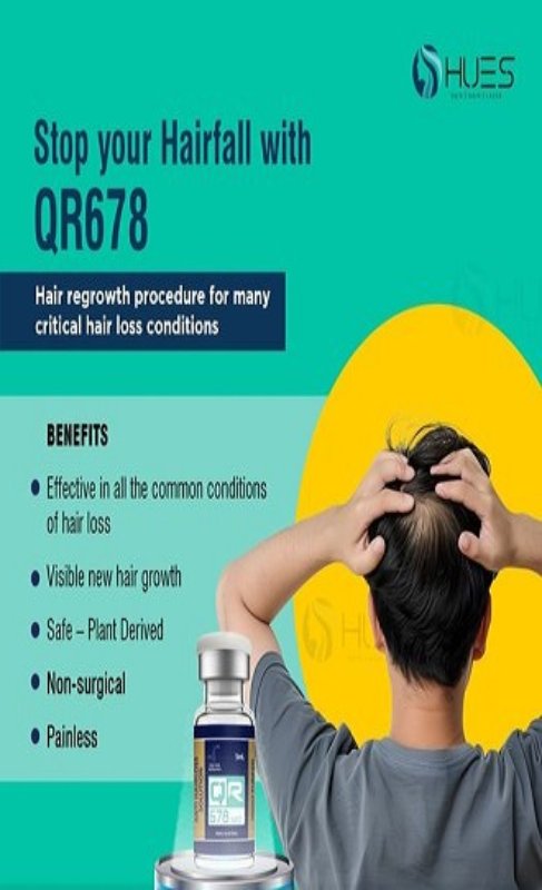 Hair Transplant in Madurai, hair clinic in Madurai, Skin Care in Madurai, Laser Treatment in Madurai, Hair Care in Madurai, hydra facial in Madurai, Hair Transplant near me, hair clinic near me, Skin Care near me, Hair Transplant in Madurai, best hair clinic in Madurai, best hydra facial in Madurai,  best hair transplantation clinic in madurai, best laser unwanted hair removal in Madurai, Best Hair Restoration in Madurai, Best Hair Replacement in Madurai, Best Hair Transplant Surgery in Madurai, Best Hair Loss Treatment in Madurai, Best Hair Grafting in Madurai, Best Hair Regrowth in Madurai, Best Hair Loss Solutions in Madurai, Best Hair Transplant Clinics in Madurai, Best Baldness Treatment in Madurai, Best Hair Transplant Recovery in Madurai, Best Hair Transplant Cost in Madurai, Best Hairline Restoration in Madurai, Best Scalp Treatments in Madurai, Best Hair Thinning Solutions in Madurai, Best skin clinic in madurai, Best laser treatment in madurai, best acne scar treatment in madurai, Best chemical peels in madurai , Best laser tattoo removal clinic in madurai , Best hair fall treatment clinic in madurai , best laser skin rejuvenation clinic in madurai , Best laser scar reduction clinic in madurai, best skin brightening treatment in Madurai, Best Hair Regrowth in Madurai, Best Hair Loss Solutions in Madurai, Best Hair Transplant Clinics in Madurai, Best Baldness Treatment in Madurai, Best Hair Transplant Recovery in Madurai, Best Hair Transplant Cost in Madurai, Best Hairline Restoration in Madurai, Best Scalp Treatments in Madurai, Best Hair Thinning Solutions in Madurai, Best Hair Transplant Before and After in Madurai, Best Hair Transplant Consultation in Madurai, Laser Hair Removal in Madurai, Laser Skin Therapy in Madurai, Laser Skin Resurfacing in Madurai, Best Follicular Unit Transplantation (FUT) in Madurai, Best Follicular Unit Extraction (FUE) in Madurai, Best Scalp Micropigmentation in Madurai, Best  Dark Circle Solutions in Madurai, Black Eye Treatment  in Madurai, Best Beauty Therapist in Madurai, Color-Centric Skincare in Madurai, Hue-Based Skin Treatment in Madurai, Skincare for All Hues in Madurai, Skin Care for Diverse Hues in Madurai, Skin Tone-Specific Treatments in Madurai, Skincare Solutions for Every Hue in Madurai, Hue-Specific Dermatology in Madurai, Skincare by Skin Tone in Madurai, Tailored Skin Treatment for Hues in Madurai, Personalized Skincare by Hues in Madurai, Skin Care for Various Hues in Madurai, Color-Based Skin Care in Madurai, Skin Health for All Tones in Madurai, Laser Skin Tightening in Madurai, Laser Wrinkle Reduction in Madurai, Laser Scar Removal in Madurai, Laser Pigmentation Treatment in Madurai, Laser Acne Treatment in Madurai, Laser Skin Rejuvenation in Madurai, Laser Tattoo Removal in Madurai, Non-Invasive Laser Treatment in Madurai, Laser Skin Care in Madurai, Medical Laser Treatment in Madurai, Laser Dermatology in Madurai, Advanced Laser Therapy in Madurai, Cosmetic Laser Procedures in Madurai, Laser Anti-Aging in Madurai, Fractional Laser Treatment in Madurai, Laser Treatment Recovery in Madurai, Hair Treatment in Madurai, Hair Restoration in Madurai, Hair Health in Madurai, Hair Growth in Madurai, Hair Repair in Madurai, Hair Loss Prevention in Madurai, Hair Conditioning in Madurai, Hair Strengthening in Madurai, Scalp Treatment in Madurai, Hair Moisturization in Madurai, Split Ends Repair in Madurai, Natural Hair Treatments in Madurai, Hair Coloring in Madurai, Heat Damage Repair in Madurai, Hair Masks in Madurai, Organic Hair Care in Madurai, Hair Shine in Madurai, Frizz Control in Madurai, Hair Serums in Madurai.
