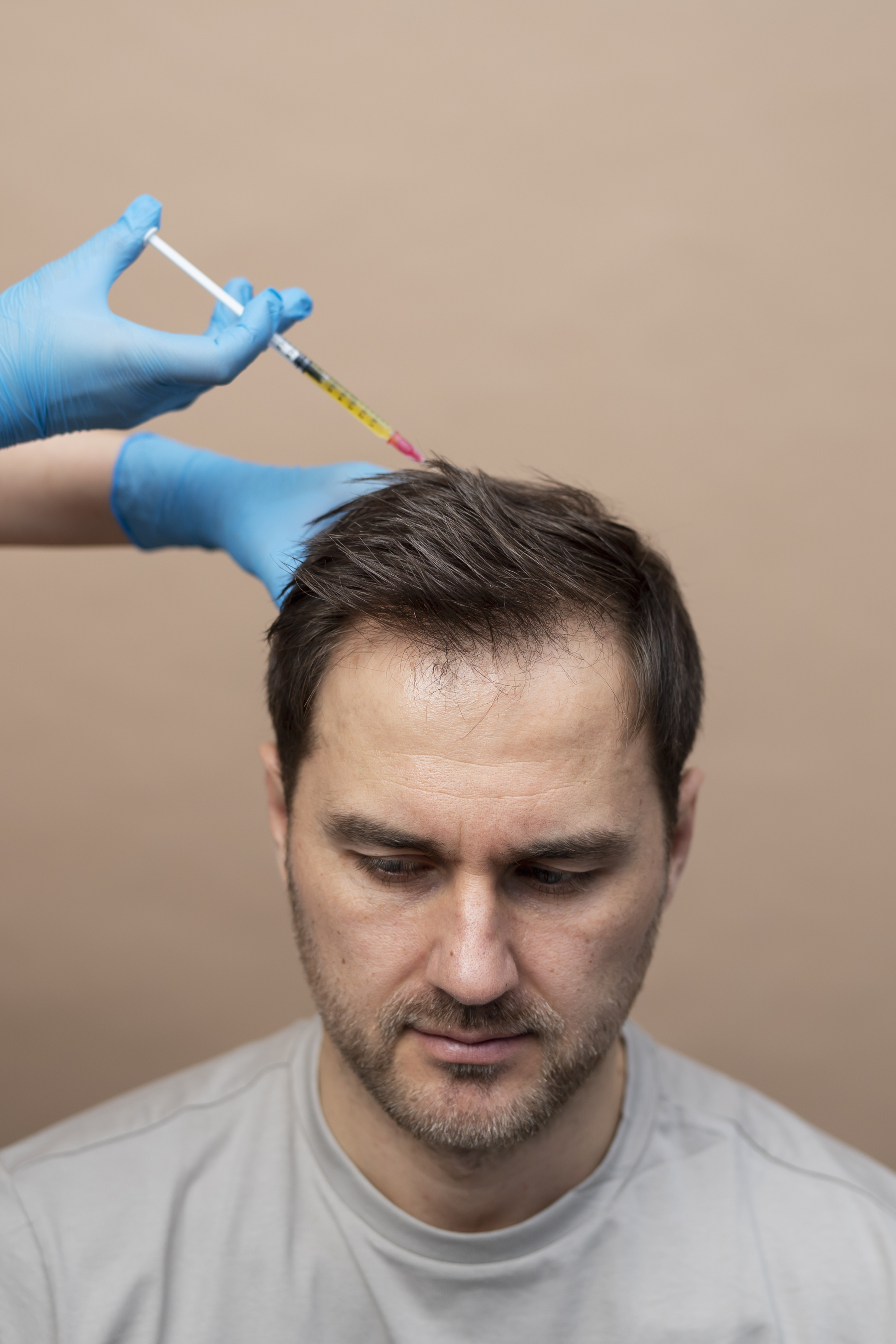 Hair Transplant in Madurai, hair clinic in Madurai, Skin Care in Madurai, Laser Treatment in Madurai, Hair Care in Madurai, hydra facial in Madurai, Hair Transplant near me, hair clinic near me, Skin Care near me, Hair Transplant in Madurai, best hair clinic in Madurai, best hydra facial in Madurai,  best hair transplantation clinic in madurai, best laser unwanted hair removal in Madurai, Best Hair Restoration in Madurai, Best Hair Replacement in Madurai, Best Hair Transplant Surgery in Madurai, Best Hair Loss Treatment in Madurai, Best Hair Grafting in Madurai, Best Hair Regrowth in Madurai, Best Hair Loss Solutions in Madurai, Best Hair Transplant Clinics in Madurai, Best Baldness Treatment in Madurai, Best Hair Transplant Recovery in Madurai, Best Hair Transplant Cost in Madurai, Best Hairline Restoration in Madurai, Best Scalp Treatments in Madurai, Best Hair Thinning Solutions in Madurai, Best skin clinic in madurai, Best laser treatment in madurai, best acne scar treatment in madurai, Best chemical peels in madurai , Best laser tattoo removal clinic in madurai , Best hair fall treatment clinic in madurai , best laser skin rejuvenation clinic in madurai , Best laser scar reduction clinic in madurai, best skin brightening treatment in Madurai, Best Hair Regrowth in Madurai, Best Hair Loss Solutions in Madurai, Best Hair Transplant Clinics in Madurai, Best Baldness Treatment in Madurai, Best Hair Transplant Recovery in Madurai, Best Hair Transplant Cost in Madurai, Best Hairline Restoration in Madurai, Best Scalp Treatments in Madurai, Best Hair Thinning Solutions in Madurai, Best Hair Transplant Before and After in Madurai, Best Hair Transplant Consultation in Madurai, Laser Hair Removal in Madurai, Laser Skin Therapy in Madurai, Laser Skin Resurfacing in Madurai, Best Follicular Unit Transplantation (FUT) in Madurai, Best Follicular Unit Extraction (FUE) in Madurai, Best Scalp Micropigmentation in Madurai, Best  Dark Circle Solutions in Madurai, Black Eye Treatment  in Madurai, Best Beauty Therapist in Madurai, Color-Centric Skincare in Madurai, Hue-Based Skin Treatment in Madurai, Skincare for All Hues in Madurai, Skin Care for Diverse Hues in Madurai, Skin Tone-Specific Treatments in Madurai, Skincare Solutions for Every Hue in Madurai, Hue-Specific Dermatology in Madurai, Skincare by Skin Tone in Madurai, Tailored Skin Treatment for Hues in Madurai, Personalized Skincare by Hues in Madurai, Skin Care for Various Hues in Madurai, Color-Based Skin Care in Madurai, Skin Health for All Tones in Madurai, Laser Skin Tightening in Madurai, Laser Wrinkle Reduction in Madurai, Laser Scar Removal in Madurai, Laser Pigmentation Treatment in Madurai, Laser Acne Treatment in Madurai, Laser Skin Rejuvenation in Madurai, Laser Tattoo Removal in Madurai, Non-Invasive Laser Treatment in Madurai, Laser Skin Care in Madurai, Medical Laser Treatment in Madurai, Laser Dermatology in Madurai, Advanced Laser Therapy in Madurai, Cosmetic Laser Procedures in Madurai, Laser Anti-Aging in Madurai, Fractional Laser Treatment in Madurai, Laser Treatment Recovery in Madurai, Hair Treatment in Madurai, Hair Restoration in Madurai, Hair Health in Madurai, Hair Growth in Madurai, Hair Repair in Madurai, Hair Loss Prevention in Madurai, Hair Conditioning in Madurai, Hair Strengthening in Madurai, Scalp Treatment in Madurai, Hair Moisturization in Madurai, Split Ends Repair in Madurai, Natural Hair Treatments in Madurai, Hair Coloring in Madurai, Heat Damage Repair in Madurai, Hair Masks in Madurai, Organic Hair Care in Madurai, Hair Shine in Madurai, Frizz Control in Madurai, Hair Serums in Madurai.