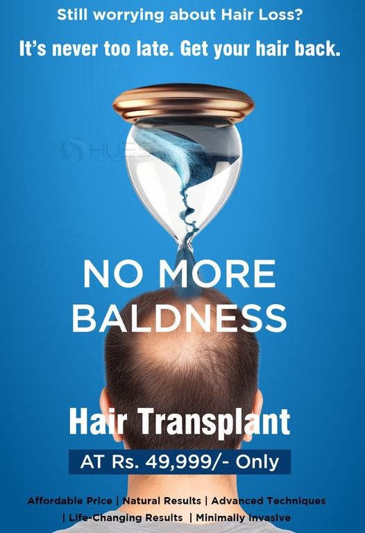 Hair Transplant in Madurai, hair clinic in Madurai, Skin Care in Madurai, Laser Treatment in Madurai, Hair Care in Madurai, hydra facial in Madurai, Hair Transplant near me, hair clinic near me, Skin Care near me, Hair Transplant in Madurai, best hair clinic in Madurai, best hydra facial in Madurai,  best hair transplantation clinic in madurai, best laser unwanted hair removal in Madurai, Best Hair Restoration in Madurai, Best Hair Replacement in Madurai, Best Hair Transplant Surgery in Madurai, Best Hair Loss Treatment in Madurai, Best Hair Grafting in Madurai, Best Hair Regrowth in Madurai, Best Hair Loss Solutions in Madurai, Best Hair Transplant Clinics in Madurai, Best Baldness Treatment in Madurai, Best Hair Transplant Recovery in Madurai, Best Hair Transplant Cost in Madurai, Best Hairline Restoration in Madurai, Best Scalp Treatments in Madurai, Best Hair Thinning Solutions in Madurai, Best skin clinic in madurai, Best laser treatment in madurai, best acne scar treatment in madurai, Best chemical peels in madurai , Best laser tattoo removal clinic in madurai , Best hair fall treatment clinic in madurai , best laser skin rejuvenation clinic in madurai , Best laser scar reduction clinic in madurai, best skin brightening treatment in Madurai, Best Hair Regrowth in Madurai, Best Hair Loss Solutions in Madurai, Best Hair Transplant Clinics in Madurai, Best Baldness Treatment in Madurai, Best Hair Transplant Recovery in Madurai, Best Hair Transplant Cost in Madurai, Best Hairline Restoration in Madurai, Best Scalp Treatments in Madurai, Best Hair Thinning Solutions in Madurai, Best Hair Transplant Before and After in Madurai, Best Hair Transplant Consultation in Madurai, Laser Hair Removal in Madurai, Laser Skin Therapy in Madurai, Laser Skin Resurfacing in Madurai, Best Follicular Unit Transplantation (FUT) in Madurai, Best Follicular Unit Extraction (FUE) in Madurai, Best Scalp Micropigmentation in Madurai, Best  Dark Circle Solutions in Madurai, Black Eye Treatment  in Madurai, Best Beauty Therapist in Madurai, Color-Centric Skincare in Madurai, Hue-Based Skin Treatment in Madurai, Skincare for All Hues in Madurai, Skin Care for Diverse Hues in Madurai, Skin Tone-Specific Treatments in Madurai, Skincare Solutions for Every Hue in Madurai, Hue-Specific Dermatology in Madurai, Skincare by Skin Tone in Madurai, Tailored Skin Treatment for Hues in Madurai, Personalized Skincare by Hues in Madurai, Skin Care for Various Hues in Madurai, Color-Based Skin Care in Madurai, Skin Health for All Tones in Madurai, Laser Skin Tightening in Madurai, Laser Wrinkle Reduction in Madurai, Laser Scar Removal in Madurai, Laser Pigmentation Treatment in Madurai, Laser Acne Treatment in Madurai, Laser Skin Rejuvenation in Madurai, Laser Tattoo Removal in Madurai, Non-Invasive Laser Treatment in Madurai, Laser Skin Care in Madurai, Medical Laser Treatment in Madurai, Laser Dermatology in Madurai, Advanced Laser Therapy in Madurai, Cosmetic Laser Procedures in Madurai, Laser Anti-Aging in Madurai, Fractional Laser Treatment in Madurai, Laser Treatment Recovery in Madurai, Hair Treatment in Madurai, Hair Restoration in Madurai, Hair Health in Madurai, Hair Growth in Madurai, Hair Repair in Madurai, Hair Loss Prevention in Madurai, Hair Conditioning in Madurai, Hair Strengthening in Madurai, Scalp Treatment in Madurai, Hair Moisturization in Madurai, Split Ends Repair in Madurai, Natural Hair Treatments in Madurai, Hair Coloring in Madurai, Heat Damage Repair in Madurai, Hair Masks in Madurai, Organic Hair Care in Madurai, Hair Shine in Madurai, Frizz Control in Madurai, Hair Serums in Madurai.