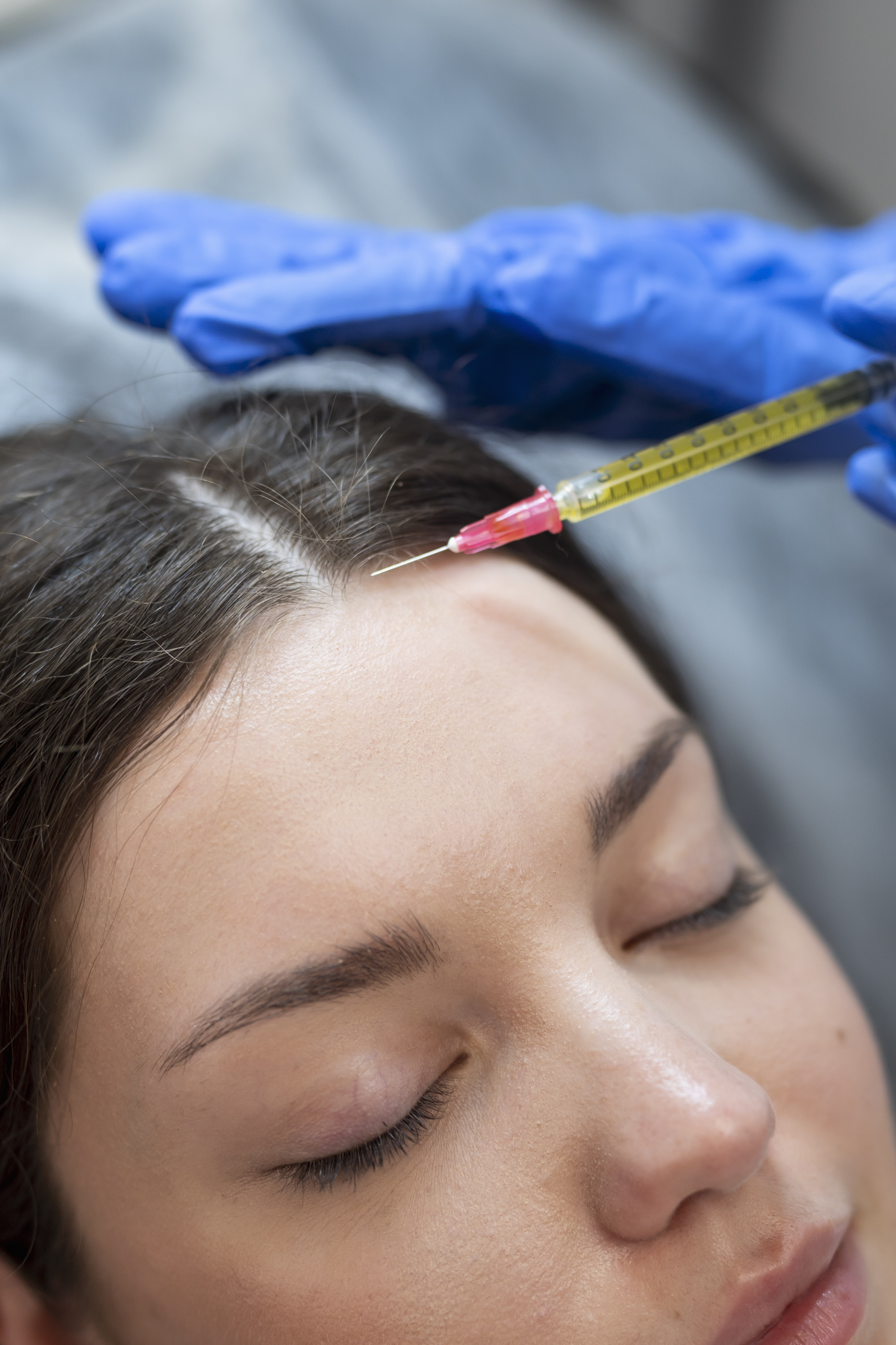 Hair Transplant in Madurai, hair clinic in Madurai, Skin Care in Madurai, Laser Treatment in Madurai, Hair Care in Madurai, hydra facial in Madurai, Hair Transplant near me, hair clinic near me, Skin Care near me, Hair Transplant in Madurai, best hair clinic in Madurai, best hydra facial in Madurai,  best hair transplantation clinic in madurai, best laser unwanted hair removal in Madurai, Best Hair Restoration in Madurai, Best Hair Replacement in Madurai, Best Hair Transplant Surgery in Madurai, Best Hair Loss Treatment in Madurai, Best Hair Grafting in Madurai, Best Hair Regrowth in Madurai, Best Hair Loss Solutions in Madurai, Best Hair Transplant Clinics in Madurai, Best Baldness Treatment in Madurai, Best Hair Transplant Recovery in Madurai, Best Hair Transplant Cost in Madurai, Best Hairline Restoration in Madurai, Best Scalp Treatments in Madurai, Best Hair Thinning Solutions in Madurai, Best skin clinic in madurai, Best laser treatment in madurai, best acne scar treatment in madurai, Best chemical peels in madurai , Best laser tattoo removal clinic in madurai , Best hair fall treatment clinic in madurai , best laser skin rejuvenation clinic in madurai , Best laser scar reduction clinic in madurai, best skin brightening treatment in Madurai, Best Hair Regrowth in Madurai, Best Hair Loss Solutions in Madurai, Best Hair Transplant Clinics in Madurai, Best Baldness Treatment in Madurai, Best Hair Transplant Recovery in Madurai, Best Hair Transplant Cost in Madurai, Best Hairline Restoration in Madurai, Best Scalp Treatments in Madurai, Best Hair Thinning Solutions in Madurai, Best Hair Transplant Before and After in Madurai, Best Hair Transplant Consultation in Madurai, Laser Hair Removal in Madurai, Laser Skin Therapy in Madurai, Laser Skin Resurfacing in Madurai, Best Follicular Unit Transplantation (FUT) in Madurai, Best Follicular Unit Extraction (FUE) in Madurai, Best Scalp Micropigmentation in Madurai, Best  Dark Circle Solutions in Madurai, Black Eye Treatment  in Madurai, Best Beauty Therapist in Madurai, Color-Centric Skincare in Madurai, Hue-Based Skin Treatment in Madurai, Skincare for All Hues in Madurai, Skin Care for Diverse Hues in Madurai, Skin Tone-Specific Treatments in Madurai, Skincare Solutions for Every Hue in Madurai, Hue-Specific Dermatology in Madurai, Skincare by Skin Tone in Madurai, Tailored Skin Treatment for Hues in Madurai, Personalized Skincare by Hues in Madurai, Skin Care for Various Hues in Madurai, Color-Based Skin Care in Madurai, Skin Health for All Tones in Madurai, Laser Skin Tightening in Madurai, Laser Wrinkle Reduction in Madurai, Laser Scar Removal in Madurai, Laser Pigmentation Treatment in Madurai, Laser Acne Treatment in Madurai, Laser Skin Rejuvenation in Madurai, Laser Tattoo Removal in Madurai, Non-Invasive Laser Treatment in Madurai, Laser Skin Care in Madurai, Medical Laser Treatment in Madurai, Laser Dermatology in Madurai, Advanced Laser Therapy in Madurai, Cosmetic Laser Procedures in Madurai, Laser Anti-Aging in Madurai, Fractional Laser Treatment in Madurai, Laser Treatment Recovery in Madurai, Hair Treatment in Madurai, Hair Restoration in Madurai, Hair Health in Madurai, Hair Growth in Madurai, Hair Repair in Madurai, Hair Loss Prevention in Madurai, Hair Conditioning in Madurai, Hair Strengthening in Madurai, Scalp Treatment in Madurai, Hair Moisturization in Madurai, Split Ends Repair in Madurai, Natural Hair Treatments in Madurai, Hair Coloring in Madurai, Heat Damage Repair in Madurai, Hair Masks in Madurai, Organic Hair Care in Madurai, Hair Shine in Madurai, Frizz Control in Madurai, Hair Serums in Madurai.