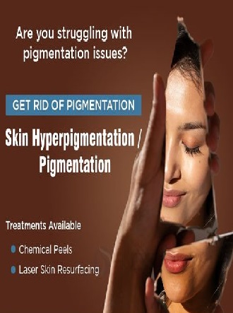 Hair Transplant in Madurai, hair clinic in Madurai, Skin Care in Madurai, Laser Treatment in Madurai, Hair Care in Madurai, hydra facial in Madurai, Hair Transplant near me, hair clinic near me, Skin Care near me, Hair Transplant in Madurai, best hair clinic in Madurai, best hydra facial in Madurai,  best hair transplantation clinic in madurai, best laser unwanted hair removal in Madurai, Best Hair Restoration in Madurai, Best Hair Replacement in Madurai, Best Hair Transplant Surgery in Madurai, Best Hair Loss Treatment in Madurai, Best Hair Grafting in Madurai, Best Hair Regrowth in Madurai, Best Hair Loss Solutions in Madurai, Best Hair Transplant Clinics in Madurai, Best Baldness Treatment in Madurai, Best Hair Transplant Recovery in Madurai, Best Hair Transplant Cost in Madurai, Best Hairline Restoration in Madurai, Best Scalp Treatments in Madurai, Best Hair Thinning Solutions in Madurai, Best skin clinic in madurai, Best laser treatment in madurai, best acne scar treatment in madurai, Best chemical peels in madurai , Best laser tattoo removal clinic in madurai , Best hair fall treatment clinic in madurai , best laser skin rejuvenation clinic in madurai , Best laser scar reduction clinic in madurai, best skin brightening treatment in Madurai, Best Hair Regrowth in Madurai, Best Hair Loss Solutions in Madurai, Best Hair Transplant Clinics in Madurai, Best Baldness Treatment in Madurai, Best Hair Transplant Recovery in Madurai, Best Hair Transplant Cost in Madurai, Best Hairline Restoration in Madurai, Best Scalp Treatments in Madurai, Best Hair Thinning Solutions in Madurai, Best Hair Transplant Before and After in Madurai, Best Hair Transplant Consultation in Madurai, Laser Hair Removal in Madurai, Laser Skin Therapy in Madurai, Laser Skin Resurfacing in Madurai, Best Follicular Unit Transplantation (FUT) in Madurai, Best Follicular Unit Extraction (FUE) in Madurai, Best Scalp Micropigmentation in Madurai, Best  Dark Circle Solutions in Madurai, Black Eye Treatment  in Madurai, Best Beauty Therapist in Madurai, Color-Centric Skincare in Madurai, Hue-Based Skin Treatment in Madurai, Skincare for All Hues in Madurai, Skin Care for Diverse Hues in Madurai, Skin Tone-Specific Treatments in Madurai, Skincare Solutions for Every Hue in Madurai, Hue-Specific Dermatology in Madurai, Skincare by Skin Tone in Madurai, Tailored Skin Treatment for Hues in Madurai, Personalized Skincare by Hues in Madurai, Skin Care for Various Hues in Madurai, Color-Based Skin Care in Madurai, Skin Health for All Tones in Madurai, Laser Skin Tightening in Madurai, Laser Wrinkle Reduction in Madurai, Laser Scar Removal in Madurai, Laser Pigmentation Treatment in Madurai, Laser Acne Treatment in Madurai, Laser Skin Rejuvenation in Madurai, Laser Tattoo Removal in Madurai, Non-Invasive Laser Treatment in Madurai, Laser Skin Care in Madurai, Medical Laser Treatment in Madurai, Laser Dermatology in Madurai, Advanced Laser Therapy in Madurai, Cosmetic Laser Procedures in Madurai, Laser Anti-Aging in Madurai, Fractional Laser Treatment in Madurai, Laser Treatment Recovery in Madurai, Hair Treatment in Madurai, Hair Restoration in Madurai, Hair Health in Madurai, Hair Growth in Madurai, Hair Repair in Madurai, Hair Loss Prevention in Madurai, Hair Conditioning in Madurai, Hair Strengthening in Madurai, Scalp Treatment in Madurai, Hair Moisturization in Madurai, Split Ends Repair in Madurai, Natural Hair Treatments in Madurai, Hair Coloring in Madurai, Heat Damage Repair in Madurai, Hair Masks in Madurai, Organic Hair Care in Madurai, Hair Shine in Madurai, Frizz Control in Madurai, Hair Serums in Madurai.