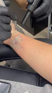Hair Transplant in Madurai, hair clinic in Madurai, Skin Care in Madurai, Laser Treatment in Madurai, Hair Care in Madurai, hydra facial in Madurai, Hair Transplant near me, hair clinic near me, Skin Care near me, Hair Transplant in Madurai, best hair clinic in Madurai, best hydra facial in Madurai,  best hair transplantation clinic in madurai, best laser unwanted hair removal in Madurai, Best Hair Restoration in Madurai, Best Hair Replacement in Madurai, Best Hair Transplant Surgery in Madurai, Best Hair Loss Treatment in Madurai, Best Hair Grafting in Madurai, Best Hair Regrowth in Madurai, Best Hair Loss Solutions in Madurai, Best Hair Transplant Clinics in Madurai, Best Baldness Treatment in Madurai, Best Hair Transplant Recovery in Madurai, Best Hair Transplant Cost in Madurai, Best Hairline Restoration in Madurai, Best Scalp Treatments in Madurai, Best Hair Thinning Solutions in Madurai, Best skin clinic in madurai, Best laser treatment in madurai, best acne scar treatment in madurai, Best chemical peels in madurai , Best laser tattoo removal clinic in madurai , Best hair fall treatment clinic in madurai , best laser skin rejuvenation clinic in madurai , Best laser scar reduction clinic in madurai, best skin brightening treatment in Madurai, Best Hair Regrowth in Madurai, Best Hair Loss Solutions in Madurai, Best Hair Transplant Clinics in Madurai, Best Baldness Treatment in Madurai, Best Hair Transplant Recovery in Madurai, Best Hair Transplant Cost in Madurai, Best Hairline Restoration in Madurai, Best Scalp Treatments in Madurai, Best Hair Thinning Solutions in Madurai, Best Hair Transplant Before and After in Madurai, Best Hair Transplant Consultation in Madurai, Laser Hair Removal in Madurai, Laser Skin Therapy in Madurai, Laser Skin Resurfacing in Madurai, Best Follicular Unit Transplantation (FUT) in Madurai, Best Follicular Unit Extraction (FUE) in Madurai, Best Scalp Micropigmentation in Madurai, Best  Dark Circle Solutions in Madurai, Black Eye Treatment  in Madurai, Best Beauty Therapist in Madurai, Color-Centric Skincare in Madurai, Hue-Based Skin Treatment in Madurai, Skincare for All Hues in Madurai, Skin Care for Diverse Hues in Madurai, Skin Tone-Specific Treatments in Madurai, Skincare Solutions for Every Hue in Madurai, Hue-Specific Dermatology in Madurai, Skincare by Skin Tone in Madurai, Tailored Skin Treatment for Hues in Madurai, Personalized Skincare by Hues in Madurai, Skin Care for Various Hues in Madurai, Color-Based Skin Care in Madurai, Skin Health for All Tones in Madurai, Laser Skin Tightening in Madurai, Laser Wrinkle Reduction in Madurai, Laser Scar Removal in Madurai, Laser Pigmentation Treatment in Madurai, Laser Acne Treatment in Madurai, Laser Skin Rejuvenation in Madurai, Laser Tattoo Removal in Madurai, Non-Invasive Laser Treatment in Madurai, Laser Skin Care in Madurai, Medical Laser Treatment in Madurai, Laser Dermatology in Madurai, Advanced Laser Therapy in Madurai, Cosmetic Laser Procedures in Madurai, Laser Anti-Aging in Madurai, Fractional Laser Treatment in Madurai, Laser Treatment Recovery in Madurai, Hair Treatment in Madurai, Hair Restoration in Madurai, Hair Health in Madurai, Hair Growth in Madurai, Hair Repair in Madurai, Hair Loss Prevention in Madurai, Hair Conditioning in Madurai, Hair Strengthening in Madurai, Scalp Treatment in Madurai, Hair Moisturization in Madurai, Split Ends Repair in Madurai, Natural Hair Treatments in Madurai, Hair Coloring in Madurai, Heat Damage Repair in Madurai, Hair Masks in Madurai, Organic Hair Care in Madurai, Hair Shine in Madurai, Frizz Control in Madurai, Hair Serums in Madurai.