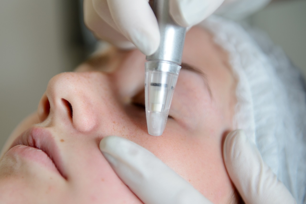 Hair Transplant in Madurai, hair clinic in Madurai, Skin Care in Madurai, Laser Treatment in Madurai, Hair Care in Madurai, hydra facial in Madurai, Hair Transplant near me, hair clinic near me, Skin Care near me, Hair Transplant in Madurai, best hair clinic in Madurai, best hydra facial in Madurai,  best hair transplantation clinic in madurai, best laser unwanted hair removal in Madurai, Best Hair Restoration in Madurai, Best Hair Replacement in Madurai, Best Hair Transplant Surgery in Madurai, Best Hair Loss Treatment in Madurai, Best Hair Grafting in Madurai, Best Hair Regrowth in Madurai, Best Hair Loss Solutions in Madurai, Best Hair Transplant Clinics in Madurai, Best Baldness Treatment in Madurai, Best Hair Transplant Recovery in Madurai, Best Hair Transplant Cost in Madurai, Best Hairline Restoration in Madurai, Best Scalp Treatments in Madurai, Best Hair Thinning Solutions in Madurai, Best skin clinic in madurai, Best laser treatment in madurai, best acne scar treatment in madurai, Best chemical peels in madurai , Best laser tattoo removal clinic in madurai , Best hair fall treatment clinic in madurai , best laser skin rejuvenation clinic in madurai , Best laser scar reduction clinic in madurai, best skin brightening treatment in Madurai, Best Hair Regrowth in Madurai, Best Hair Loss Solutions in Madurai, Best Hair Transplant Clinics in Madurai, Best Baldness Treatment in Madurai, Best Hair Transplant Recovery in Madurai, Best Hair Transplant Cost in Madurai, Best Hairline Restoration in Madurai, Best Scalp Treatments in Madurai, Best Hair Thinning Solutions in Madurai, Best Hair Transplant Before and After in Madurai, Best Hair Transplant Consultation in Madurai, Laser Hair Removal in Madurai, Laser Skin Therapy in Madurai, Laser Skin Resurfacing in Madurai, Best Follicular Unit Transplantation (FUT) in Madurai, Best Follicular Unit Extraction (FUE) in Madurai, Best Scalp Micropigmentation in Madurai, Best  Dark Circle Solutions in Madurai, Black Eye Treatment  in Madurai, Best Beauty Therapist in Madurai, Color-Centric Skincare in Madurai, Hue-Based Skin Treatment in Madurai, Skincare for All Hues in Madurai, Skin Care for Diverse Hues in Madurai, Skin Tone-Specific Treatments in Madurai, Skincare Solutions for Every Hue in Madurai, Hue-Specific Dermatology in Madurai, Skincare by Skin Tone in Madurai, Tailored Skin Treatment for Hues in Madurai, Personalized Skincare by Hues in Madurai, Skin Care for Various Hues in Madurai, Color-Based Skin Care in Madurai, Skin Health for All Tones in Madurai, Laser Skin Tightening in Madurai, Laser Wrinkle Reduction in Madurai, Laser Scar Removal in Madurai, Laser Pigmentation Treatment in Madurai, Laser Acne Treatment in Madurai, Laser Skin Rejuvenation in Madurai, Laser Tattoo Removal in Madurai, Non-Invasive Laser Treatment in Madurai, Laser Skin Care in Madurai, Medical Laser Treatment in Madurai, Laser Dermatology in Madurai, Advanced Laser Therapy in Madurai, Cosmetic Laser Procedures in Madurai, Laser Anti-Aging in Madurai, Fractional Laser Treatment in Madurai, Laser Treatment Recovery in Madurai, Hair Treatment in Madurai, Hair Restoration in Madurai, Hair Health in Madurai, Hair Growth in Madurai, Hair Repair in Madurai, Hair Loss Prevention in Madurai, Hair Conditioning in Madurai, Hair Strengthening in Madurai, Scalp Treatment in Madurai, Hair Moisturization in Madurai, Split Ends Repair in Madurai, Natural Hair Treatments in Madurai, Hair Coloring in Madurai, Heat Damage Repair in Madurai, Hair Masks in Madurai, Organic Hair Care in Madurai, Hair Shine in Madurai, Frizz Control in Madurai, Hair Serums in Madurai.