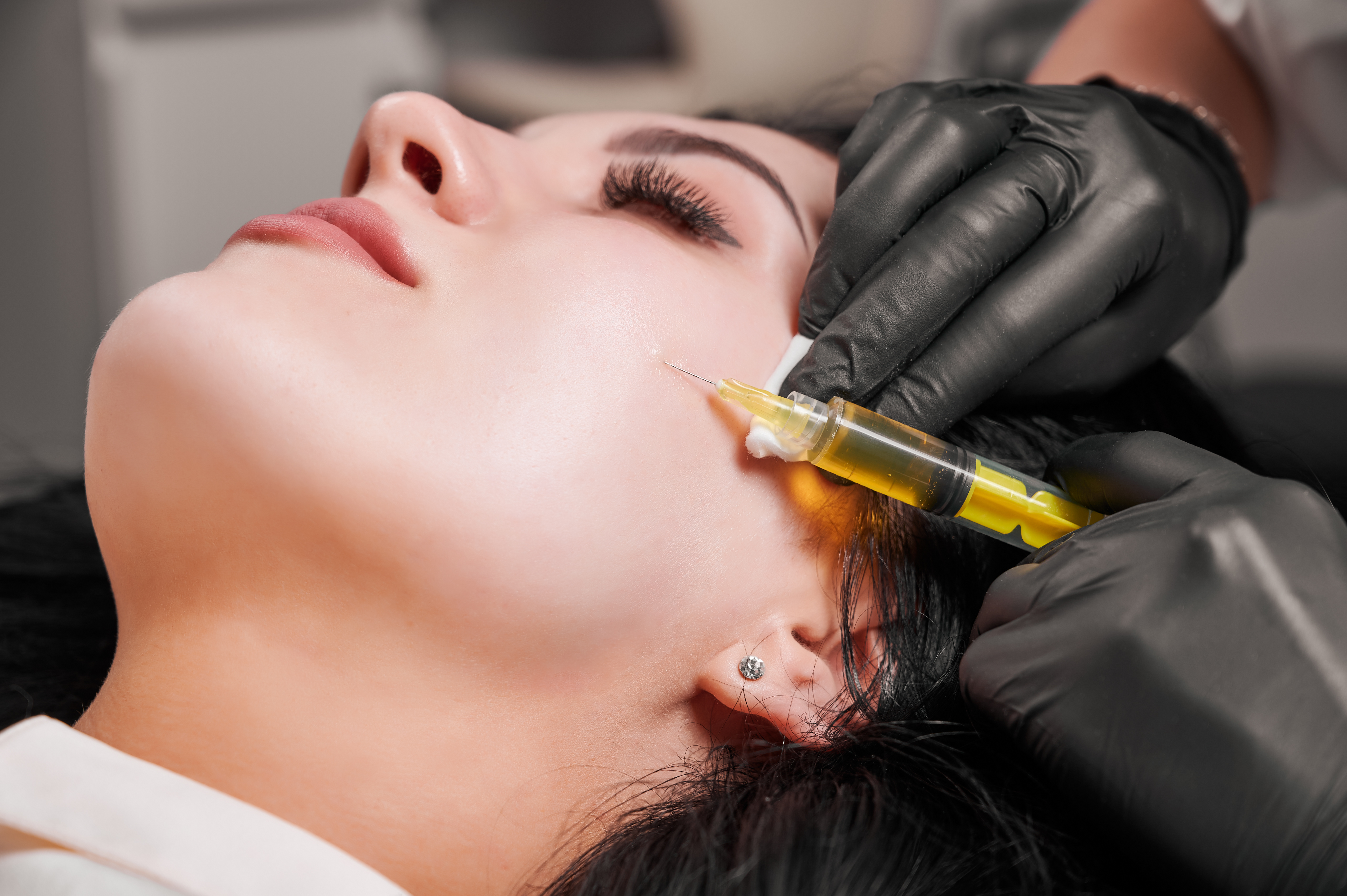 Hair Transplant in Madurai, hair clinic in Madurai, Skin Care in Madurai, Laser Treatment in Madurai, Hair Care in Madurai, hydra facial in Madurai, Hair Transplant near me, hair clinic near me, Skin Care near me, Hair Transplant in Madurai, best hair clinic in Madurai, best hydra facial in Madurai,  best hair transplantation clinic in madurai, best laser unwanted hair removal in Madurai, Best Hair Restoration in Madurai, Best Hair Replacement in Madurai, Best Hair Transplant Surgery in Madurai, Best Hair Loss Treatment in Madurai, Best Hair Grafting in Madurai, Best Hair Regrowth in Madurai, Best Hair Loss Solutions in Madurai, Best Hair Transplant Clinics in Madurai, Best Baldness Treatment in Madurai, Best Hair Transplant Recovery in Madurai, Best Hair Transplant Cost in Madurai, Best Hairline Restoration in Madurai, Best Scalp Treatments in Madurai, Best Hair Thinning Solutions in Madurai, Best skin clinic in madurai, Best laser treatment in madurai, best acne scar treatment in madurai, Best chemical peels in madurai , Best laser tattoo removal clinic in madurai , Best hair fall treatment clinic in madurai , best laser skin rejuvenation clinic in madurai , Best laser scar reduction clinic in madurai, best skin brightening treatment in Madurai, Best Hair Regrowth in Madurai, Best Hair Loss Solutions in Madurai, Best Hair Transplant Clinics in Madurai, Best Baldness Treatment in Madurai, Best Hair Transplant Recovery in Madurai, Best Hair Transplant Cost in Madurai, Best Hairline Restoration in Madurai, Best Scalp Treatments in Madurai, Best Hair Thinning Solutions in Madurai, Best Hair Transplant Before and After in Madurai, Best Hair Transplant Consultation in Madurai, Laser Hair Removal in Madurai, Laser Skin Therapy in Madurai, Laser Skin Resurfacing in Madurai, Best Follicular Unit Transplantation (FUT) in Madurai, Best Follicular Unit Extraction (FUE) in Madurai, Best Scalp Micropigmentation in Madurai, Best  Dark Circle Solutions in Madurai, Black Eye Treatment  in Madurai, Best Beauty Therapist in Madurai, Color-Centric Skincare in Madurai, Hue-Based Skin Treatment in Madurai, Skincare for All Hues in Madurai, Skin Care for Diverse Hues in Madurai, Skin Tone-Specific Treatments in Madurai, Skincare Solutions for Every Hue in Madurai, Hue-Specific Dermatology in Madurai, Skincare by Skin Tone in Madurai, Tailored Skin Treatment for Hues in Madurai, Personalized Skincare by Hues in Madurai, Skin Care for Various Hues in Madurai, Color-Based Skin Care in Madurai, Skin Health for All Tones in Madurai, Laser Skin Tightening in Madurai, Laser Wrinkle Reduction in Madurai, Laser Scar Removal in Madurai, Laser Pigmentation Treatment in Madurai, Laser Acne Treatment in Madurai, Laser Skin Rejuvenation in Madurai, Laser Tattoo Removal in Madurai, Non-Invasive Laser Treatment in Madurai, Laser Skin Care in Madurai, Medical Laser Treatment in Madurai, Laser Dermatology in Madurai, Advanced Laser Therapy in Madurai, Cosmetic Laser Procedures in Madurai, Laser Anti-Aging in Madurai, Fractional Laser Treatment in Madurai, Laser Treatment Recovery in Madurai, Hair Treatment in Madurai, Hair Restoration in Madurai, Hair Health in Madurai, Hair Growth in Madurai, Hair Repair in Madurai, Hair Loss Prevention in Madurai, Hair Conditioning in Madurai, Hair Strengthening in Madurai, Scalp Treatment in Madurai, Hair Moisturization in Madurai, Split Ends Repair in Madurai, Natural Hair Treatments in Madurai, Hair Coloring in Madurai, Heat Damage Repair in Madurai, Hair Masks in Madurai, Organic Hair Care in Madurai, Hair Shine in Madurai, Frizz Control in Madurai, Hair Serums in Madurai.