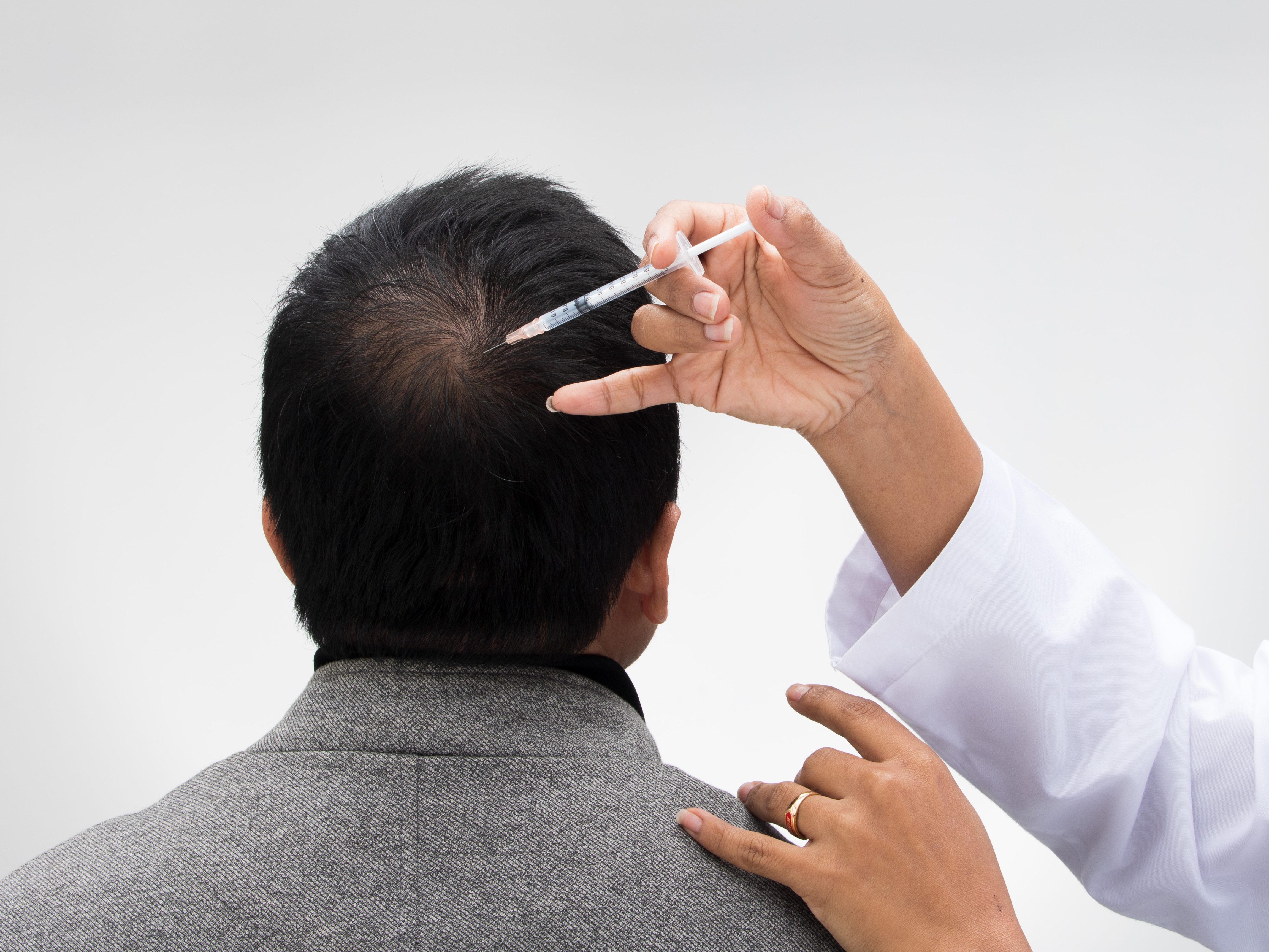 Hair Transplant in Madurai, hair clinic in Madurai, Skin Care in Madurai, Laser Treatment in Madurai, Hair Care in Madurai, hydra facial in Madurai, Hair Transplant near me, hair clinic near me, Skin Care near me, Hair Transplant in Madurai, best hair clinic in Madurai, best hydra facial in Madurai,  best hair transplantation clinic in madurai, best laser unwanted hair removal in Madurai, Best Hair Restoration in Madurai, Best Hair Replacement in Madurai, Best Hair Transplant Surgery in Madurai, Best Hair Loss Treatment in Madurai, Best Hair Grafting in Madurai, Best Hair Regrowth in Madurai, Best Hair Loss Solutions in Madurai, Best Hair Transplant Clinics in Madurai, Best Baldness Treatment in Madurai, Best Hair Transplant Recovery in Madurai, Best Hair Transplant Cost in Madurai, Best Hairline Restoration in Madurai, Best Scalp Treatments in Madurai, Best Hair Thinning Solutions in Madurai, Best skin clinic in madurai, Best laser treatment in madurai, best acne scar treatment in madurai, Best chemical peels in madurai , Best laser tattoo removal clinic in madurai , Best hair fall treatment clinic in madurai , best laser skin rejuvenation clinic in madurai , Best laser scar reduction clinic in madurai, best skin brightening treatment in Madurai, Best Hair Regrowth in Madurai, Best Hair Loss Solutions in Madurai, Best Hair Transplant Clinics in Madurai, Best Baldness Treatment in Madurai, Best Hair Transplant Recovery in Madurai, Best Hair Transplant Cost in Madurai, Best Hairline Restoration in Madurai, Best Scalp Treatments in Madurai, Best Hair Thinning Solutions in Madurai, Best Hair Transplant Before and After in Madurai, Best Hair Transplant Consultation in Madurai, Laser Hair Removal in Madurai, Laser Skin Therapy in Madurai, Laser Skin Resurfacing in Madurai, Best Follicular Unit Transplantation (FUT) in Madurai, Best Follicular Unit Extraction (FUE) in Madurai, Best Scalp Micropigmentation in Madurai, Best  Dark Circle Solutions in Madurai, Black Eye Treatment  in Madurai, Best Beauty Therapist in Madurai, Color-Centric Skincare in Madurai, Hue-Based Skin Treatment in Madurai, Skincare for All Hues in Madurai, Skin Care for Diverse Hues in Madurai, Skin Tone-Specific Treatments in Madurai, Skincare Solutions for Every Hue in Madurai, Hue-Specific Dermatology in Madurai, Skincare by Skin Tone in Madurai, Tailored Skin Treatment for Hues in Madurai, Personalized Skincare by Hues in Madurai, Skin Care for Various Hues in Madurai, Color-Based Skin Care in Madurai, Skin Health for All Tones in Madurai, Laser Skin Tightening in Madurai, Laser Wrinkle Reduction in Madurai, Laser Scar Removal in Madurai, Laser Pigmentation Treatment in Madurai, Laser Acne Treatment in Madurai, Laser Skin Rejuvenation in Madurai, Laser Tattoo Removal in Madurai, Non-Invasive Laser Treatment in Madurai, Laser Skin Care in Madurai, Medical Laser Treatment in Madurai, Laser Dermatology in Madurai, Advanced Laser Therapy in Madurai, Cosmetic Laser Procedures in Madurai, Laser Anti-Aging in Madurai, Fractional Laser Treatment in Madurai, Laser Treatment Recovery in Madurai, Hair Treatment in Madurai, Hair Restoration in Madurai, Hair Health in Madurai, Hair Growth in Madurai, Hair Repair in Madurai, Hair Loss Prevention in Madurai, Hair Conditioning in Madurai, Hair Strengthening in Madurai, Scalp Treatment in Madurai, Hair Moisturization in Madurai, Split Ends Repair in Madurai, Natural Hair Treatments in Madurai, Hair Coloring in Madurai, Heat Damage Repair in Madurai, Hair Masks in Madurai, Organic Hair Care in Madurai, Hair Shine in Madurai, Frizz Control in Madurai, Hair Serums in Madurai.