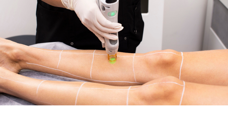 Hair Transplant in Madurai, hair clinic in Madurai, Skin Care in Madurai, Laser Treatment in Madurai, Hair Care in Madurai, hydra facial in Madurai, Hair Transplant near me, hair clinic near me, Skin Care near me, Hair Transplant in Madurai, best hair clinic in Madurai, best hydra facial in Madurai,  best hair transplantation clinic in madurai, best laser unwanted hair removal in Madurai, Best Hair Restoration in Madurai, Best Hair Replacement in Madurai, Best Hair Transplant Surgery in Madurai, Best Hair Loss Treatment in Madurai, Best Hair Grafting in Madurai, Best Hair Regrowth in Madurai, Best Hair Loss Solutions in Madurai, Best Hair Transplant Clinics in Madurai, Best Baldness Treatment in Madurai, Best Hair Transplant Recovery in Madurai, Best Hair Transplant Cost in Madurai, Best Hairline Restoration in Madurai, Best Scalp Treatments in Madurai, Best Hair Thinning Solutions in Madurai, Best skin clinic in madurai, Best laser treatment in madurai, best acne scar treatment in madurai, Best chemical peels in madurai , Best laser tattoo removal clinic in madurai , Best hair fall treatment clinic in madurai , best laser skin rejuvenation clinic in madurai , Best laser scar reduction clinic in madurai, best skin brightening treatment in Madurai, Best Hair Regrowth in Madurai, Best Hair Loss Solutions in Madurai, Best Hair Transplant Clinics in Madurai, Best Baldness Treatment in Madurai, Best Hair Transplant Recovery in Madurai, Best Hair Transplant Cost in Madurai, Best Hairline Restoration in Madurai, Best Scalp Treatments in Madurai, Best Hair Thinning Solutions in Madurai, Best Hair Transplant Before and After in Madurai, Best Hair Transplant Consultation in Madurai, Laser Hair Removal in Madurai, Laser Skin Therapy in Madurai, Laser Skin Resurfacing in Madurai, Best Follicular Unit Transplantation (FUT) in Madurai, Best Follicular Unit Extraction (FUE) in Madurai, Best Scalp Micropigmentation in Madurai, Best  Dark Circle Solutions in Madurai, Black Eye Treatment  in Madurai, Best Beauty Therapist in Madurai, Color-Centric Skincare in Madurai, Hue-Based Skin Treatment in Madurai, Skincare for All Hues in Madurai, Skin Care for Diverse Hues in Madurai, Skin Tone-Specific Treatments in Madurai, Skincare Solutions for Every Hue in Madurai, Hue-Specific Dermatology in Madurai, Skincare by Skin Tone in Madurai, Tailored Skin Treatment for Hues in Madurai, Personalized Skincare by Hues in Madurai, Skin Care for Various Hues in Madurai, Color-Based Skin Care in Madurai, Skin Health for All Tones in Madurai, Laser Skin Tightening in Madurai, Laser Wrinkle Reduction in Madurai, Laser Scar Removal in Madurai, Laser Pigmentation Treatment in Madurai, Laser Acne Treatment in Madurai, Laser Skin Rejuvenation in Madurai, Laser Tattoo Removal in Madurai, Non-Invasive Laser Treatment in Madurai, Laser Skin Care in Madurai, Medical Laser Treatment in Madurai, Laser Dermatology in Madurai, Advanced Laser Therapy in Madurai, Cosmetic Laser Procedures in Madurai, Laser Anti-Aging in Madurai, Fractional Laser Treatment in Madurai, Laser Treatment Recovery in Madurai, Hair Treatment in Madurai, Hair Restoration in Madurai, Hair Health in Madurai, Hair Growth in Madurai, Hair Repair in Madurai, Hair Loss Prevention in Madurai, Hair Conditioning in Madurai, Hair Strengthening in Madurai, Scalp Treatment in Madurai, Hair Moisturization in Madurai, Split Ends Repair in Madurai, Natural Hair Treatments in Madurai, Hair Coloring in Madurai, Heat Damage Repair in Madurai, Hair Masks in Madurai, Organic Hair Care in Madurai, Hair Shine in Madurai, Frizz Control in Madurai, Hair Serums in Madurai.